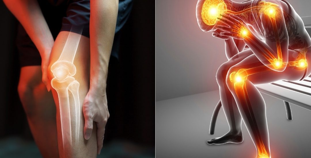 Joint Pain Remedies: Supplement Recommendations