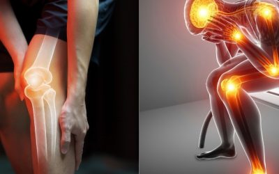 Joint Pain Remedies: Supplement Recommendations