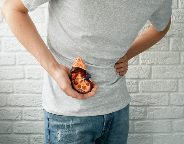 Symptoms of Kidney Stones: Key Signs to Watch For